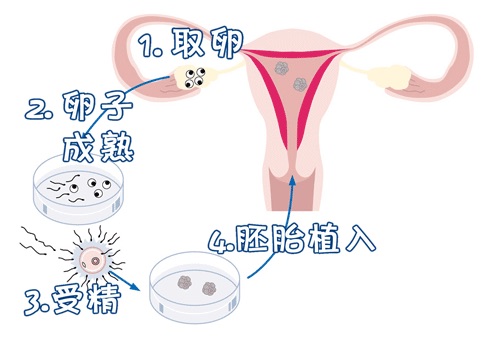 正规同性代孕咨询包生儿子